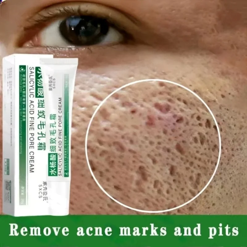 Krim Pembersih Pori Asam Salis - Skincare Salicylic Acid ulasan dan harga