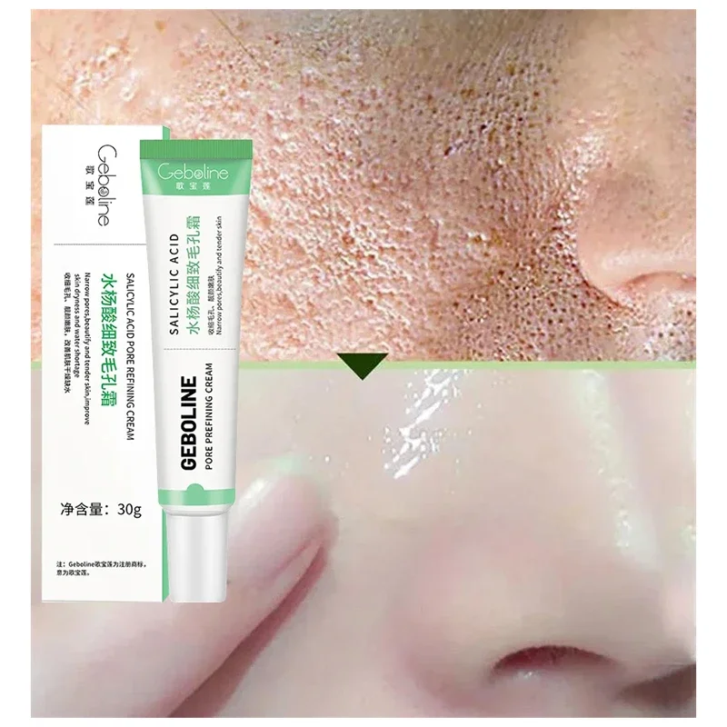 Krim Kecilkan pori asam salisi - Skincare Salicylic Acid ulasan dan harga
